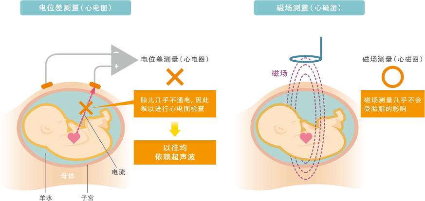 图8 通过使用MR磁性传感器的心磁图仪测量胎儿的心磁场（示意图）